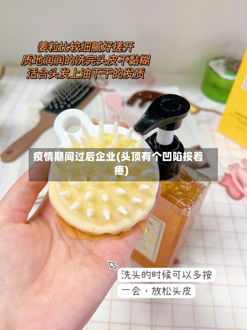 疫情期间过后企业(头顶有个凹陷按着疼)-第3张图片