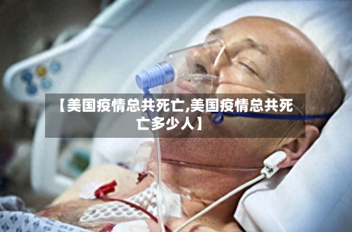 【美国疫情总共死亡,美国疫情总共死亡多少人】-第2张图片